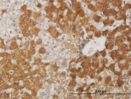 H00002308-M12 - FOXO1A