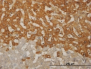 H00002308-M13 - FOXO1A