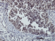 H00002309-M11 - FOXO3 / FKHRL1