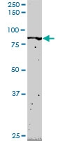 H00002313-M02 - FLI1