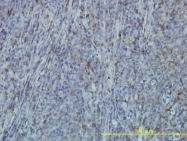 H00002316-M01 - Filamin-A