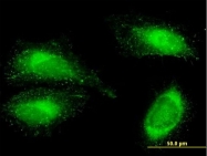 H00002335-B01P - Fibronectin