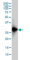 H00002483-M01 - FRG1