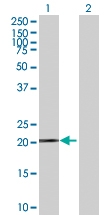 H00002495-B01P - Ferritin heavy chain (FTH1)