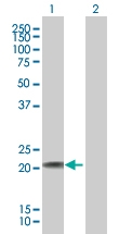 H00002495-B03 - Ferritin heavy chain (FTH1)