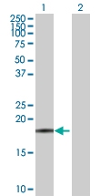 H00002512-D01P - Ferritin light chain (FTL)