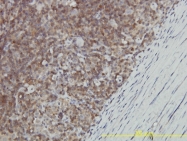 H00002592-M01 - GALT