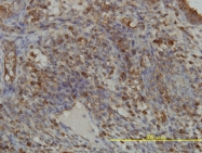 H00002618-M01 - GART