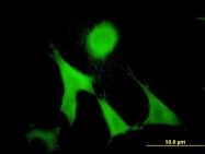 H00002620-M01 - GAS2