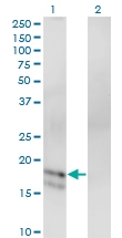 H00002641-M02 - Glucagon