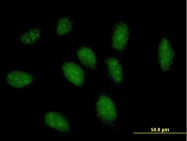 H00002643-B01P - GTP cyclohydrolase 1 (GCH1)