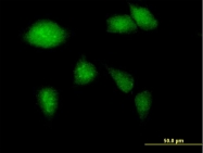 H00002645-B02P - Glucokinase / Hexokinase-4