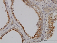 H00002678-M01 - CD224 / GGT1