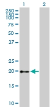H00002688-B01P - Somatotropin / Growth Hormone / GH1