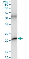 H00002688-D01 - Somatotropin / Growth Hormone / GH1