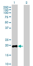 H00002688-D01P - Somatotropin / Growth Hormone / GH1