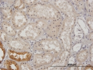 H00002710-B01P - Glycerol kinase