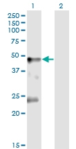 H00002741-M02 - Glycine receptor alpha-1