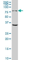 H00002744-M01 - Glutaminase kidney isoform