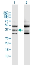 H00002767-D01P - G protein alpha 11 / GNA11