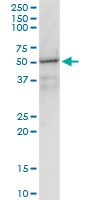 H00002770-M01 - G protein alpha inhibitor 1