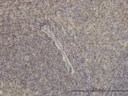 H00002770-M01 - G protein alpha inhibitor 1
