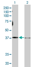 H00002778-D01P - Protein ALEX