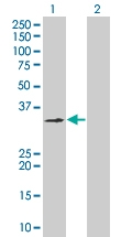 H00002781-B01 - G protein z alpha