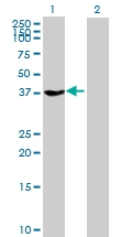 H00002781-B01P - G protein z alpha