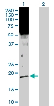 H00002810-D01P - 14-3-3 protein sigma / SFN
