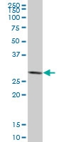 H00002810-M02 - 14-3-3 protein sigma / SFN