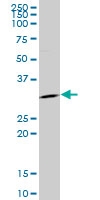 H00002810-M05 - 14-3-3 protein sigma / SFN