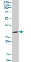 H00002810-M06 - 14-3-3 protein sigma / SFN