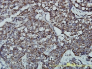 H00002827-M01 - GPR3 / ACCA
