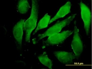 H00002896-B01 - Granulins (GRN)
