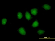 H00002908-D01P - Glucocorticoid receptor