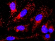 H00002932-D01P - GSK3 beta