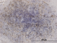 H00002932-M04 - GSK3 beta