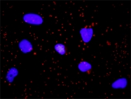 H00002932-M04 - GSK3 beta