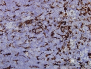 H00002934-M01 - Gelsolin