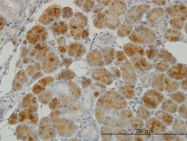 H00002936-M01 - Glutathione reductase