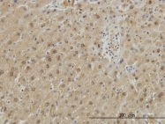 H00002938-M01 - GSTA1