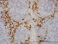 H00002940-M01 - GSTA3