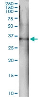 H00002967-D01 - GTF2H3