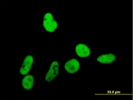 H00002969-B01P - GTF2I / TFII-I