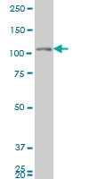 H00002984-M04 - GUCY2C / STA receptor
