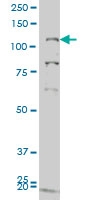H00002984-M05 - GUCY2C / STA receptor