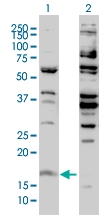 H00003021-M01 - Histone H3F3B