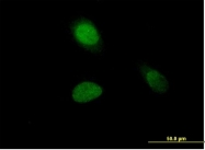 H00003024-B01P - Histone H1.1