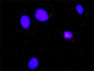 H00003059-M02 - HCLS1